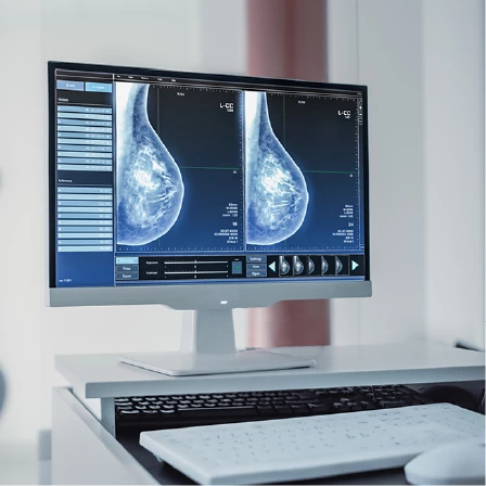 When Should I Start Breast Cancer Screening?